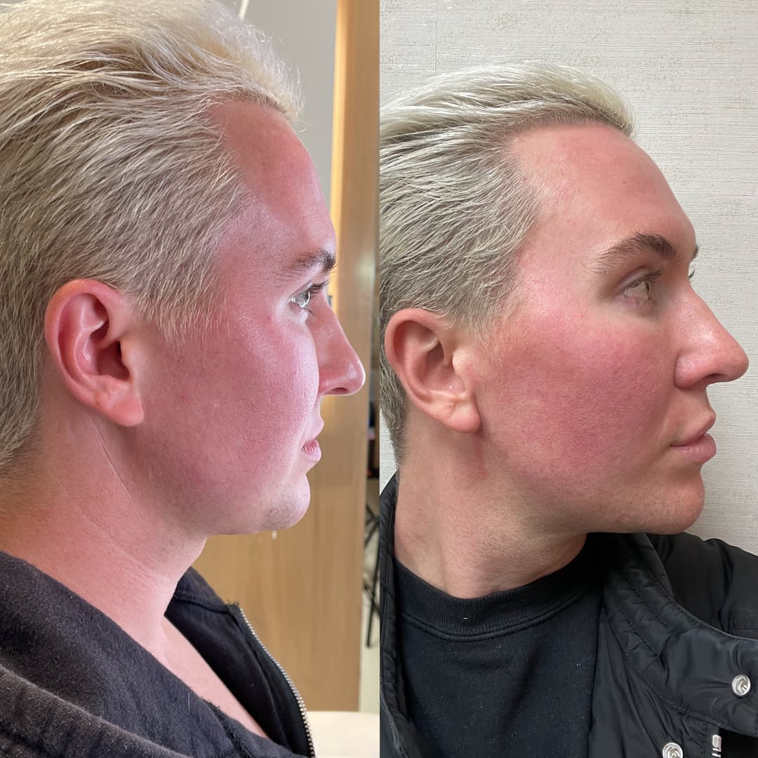 C.L. before