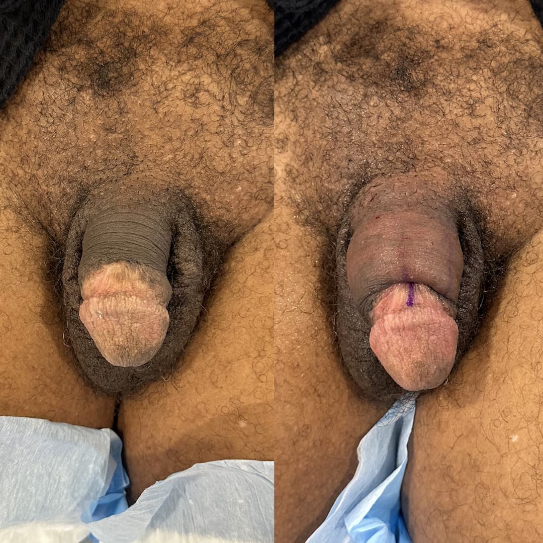 F. before